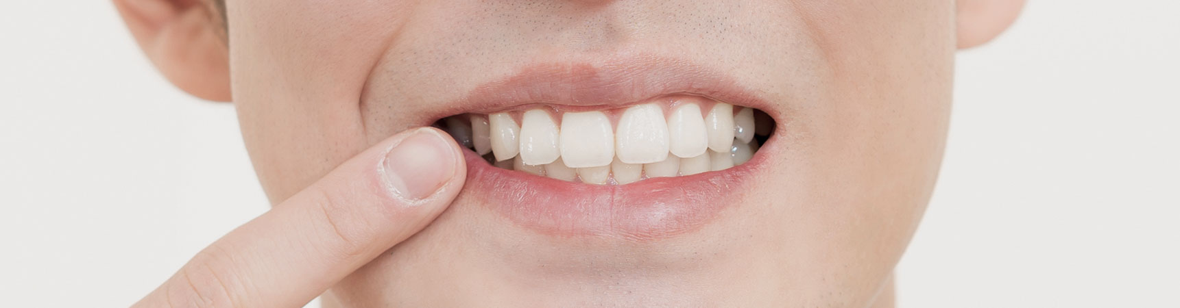 歯のホワイトニングのイメージ
